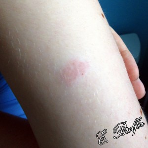 Reaction to First Pollen Shot (2)