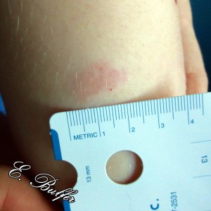 Reaction to First Pollen Shot